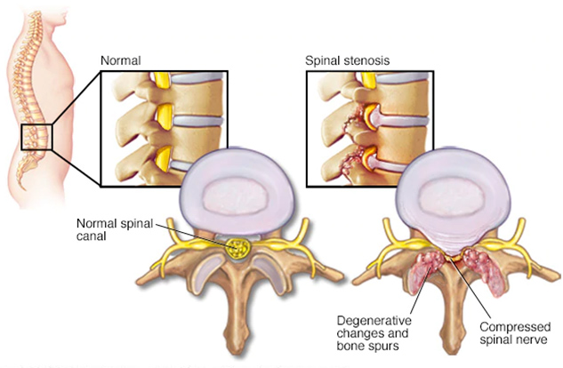 Orthopaedics Surgery in Pune